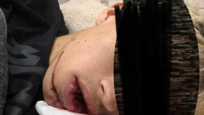 Otra salvaje golpiza: un joven de 19 años está internado tras ser atacado en una fiesta en Luján